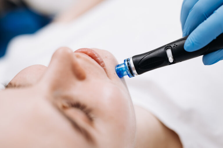 Hydrafacial Before and After Photos